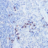 Immunohistochemistry - Anti-TLR9 Antibody (A88078) - Antibodies.com