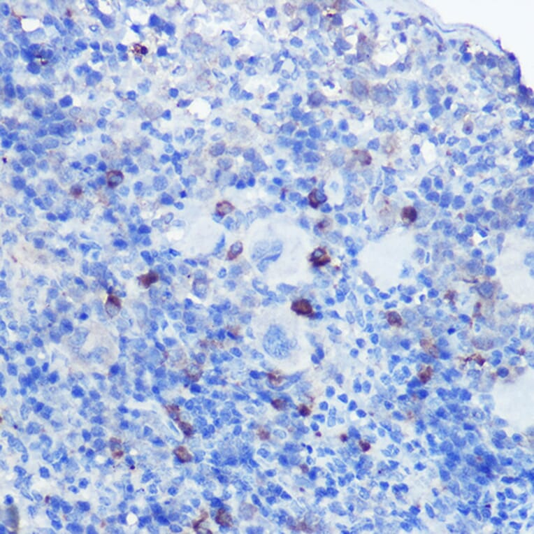 Immunohistochemistry - Anti-TLR9 Antibody (A88078) - Antibodies.com