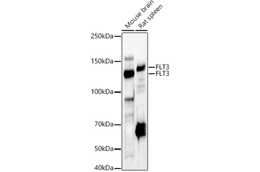 Western Blot - Anti-Flt3/CD135 Antibody (A88079) - Antibodies.com