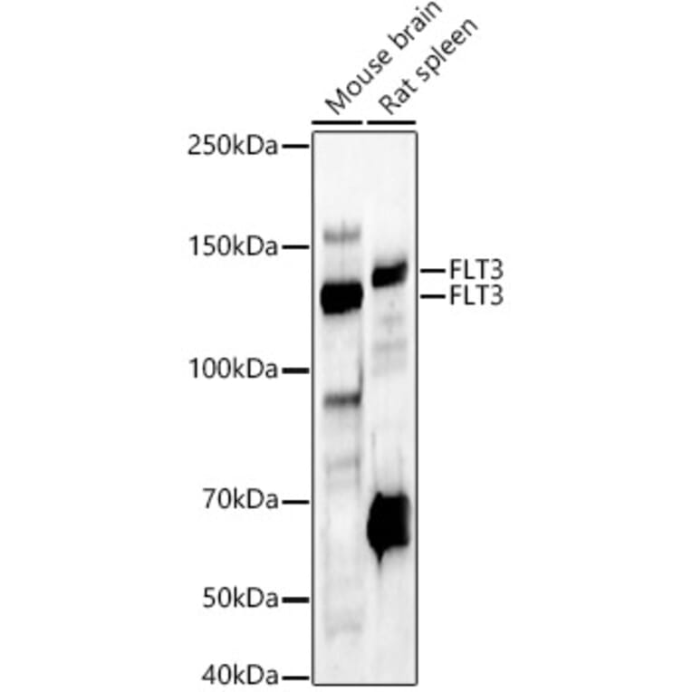 Western Blot - Anti-Flt3/CD135 Antibody (A88079) - Antibodies.com