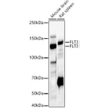 Western Blot - Anti-Flt3/CD135 Antibody (A88079) - Antibodies.com
