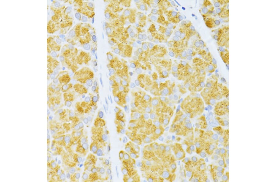 Immunohistochemistry - Anti-Flt3/CD135 Antibody (A88079) - Antibodies.com