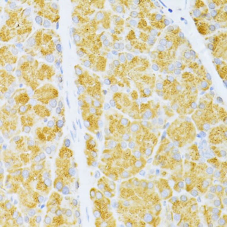Immunohistochemistry - Anti-Flt3/CD135 Antibody (A88079) - Antibodies.com