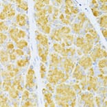 Immunohistochemistry - Anti-Flt3/CD135 Antibody (A88079) - Antibodies.com