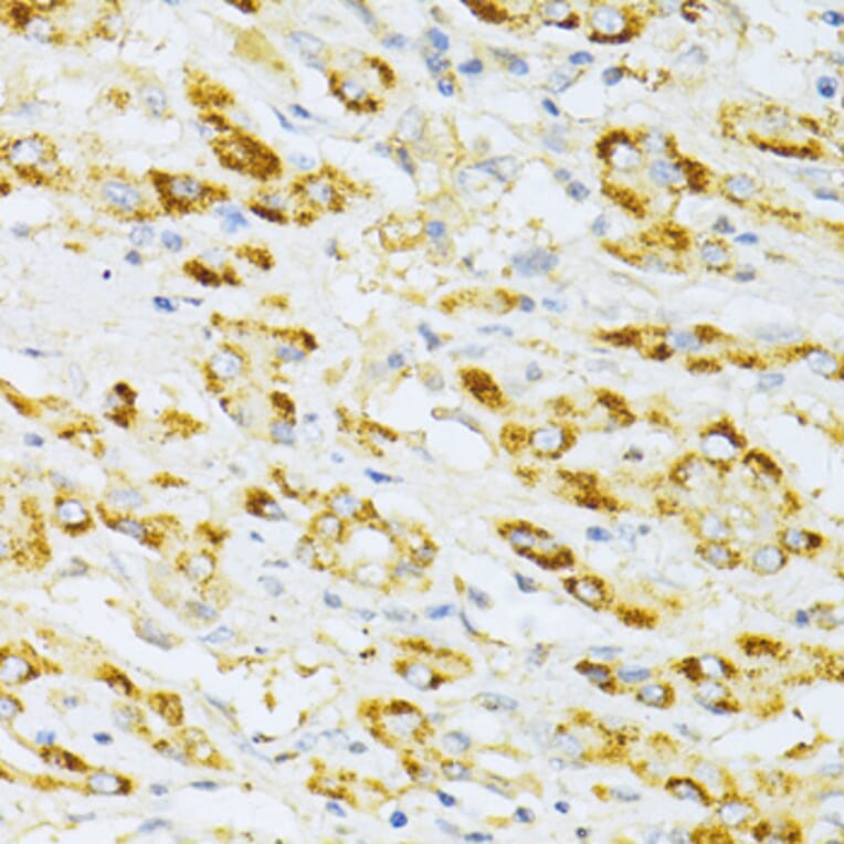Immunohistochemistry - Anti-Flt3/CD135 Antibody (A88079) - Antibodies.com