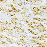 Immunohistochemistry - Anti-Flt3/CD135 Antibody (A88079) - Antibodies.com