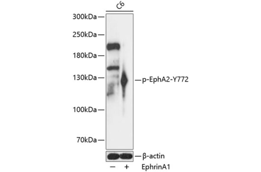 Western Blot - Anti-Eph receptor A2 (phospho Tyr772) Antibody (A88080) - Antibodies.com