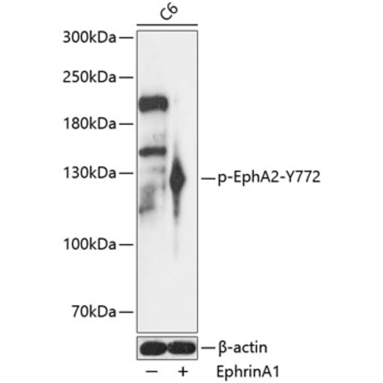 Western Blot - Anti-Eph receptor A2 (phospho Tyr772) Antibody (A88080) - Antibodies.com