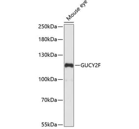 Western Blot - Anti-GC-F Antibody (A88081) - Antibodies.com