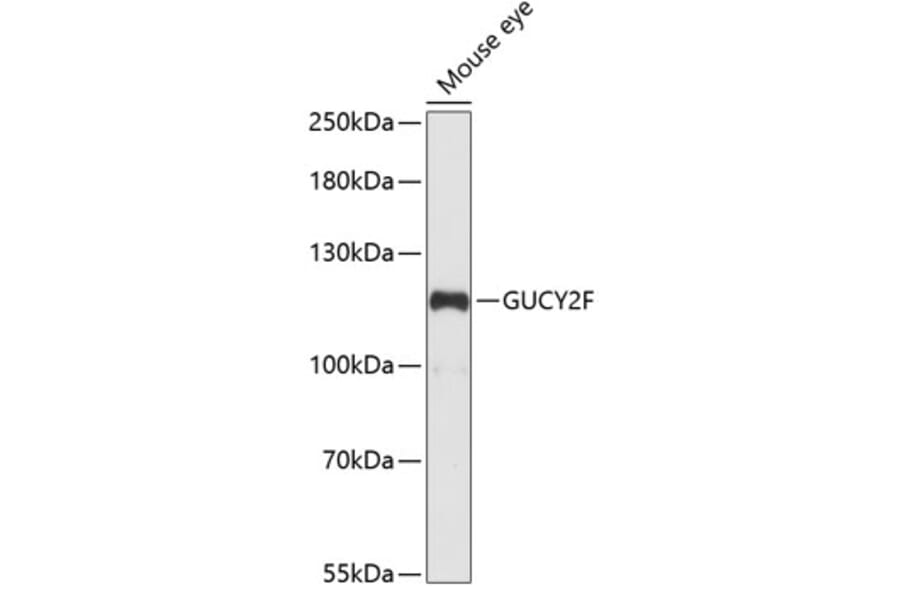 Western Blot - Anti-GC-F Antibody (A88081) - Antibodies.com