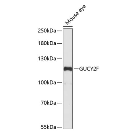 Western Blot - Anti-GC-F Antibody (A88081) - Antibodies.com