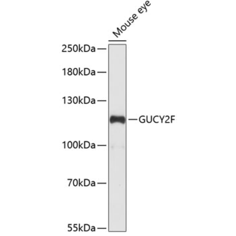 Western Blot - Anti-GC-F Antibody (A88081) - Antibodies.com