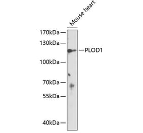 Western Blot - Anti-LH1 Antibody (A88082) - Antibodies.com