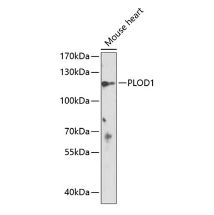 Western Blot - Anti-LH1 Antibody (A88082) - Antibodies.com