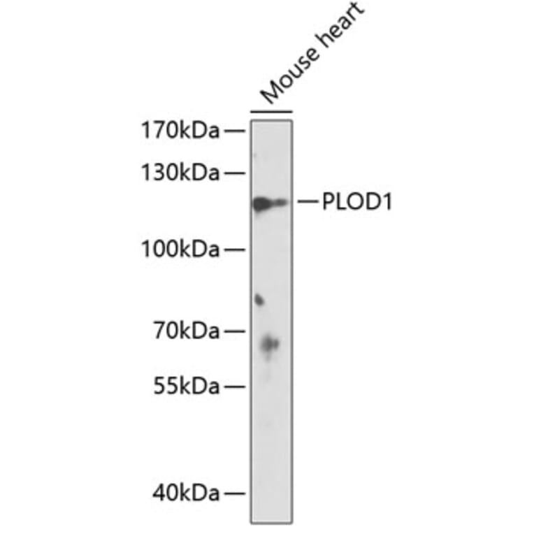 Western Blot - Anti-LH1 Antibody (A88082) - Antibodies.com