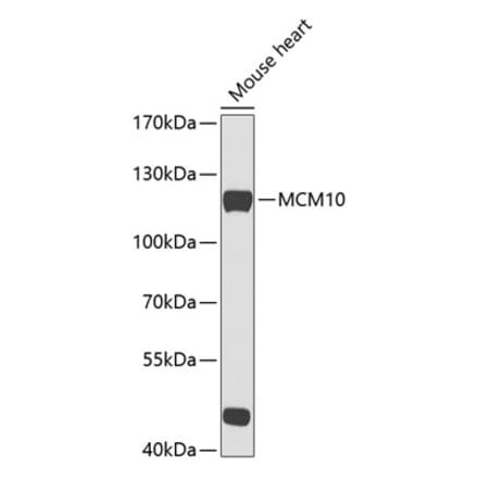 Western Blot - Anti-MCM10 Antibody (A88083) - Antibodies.com