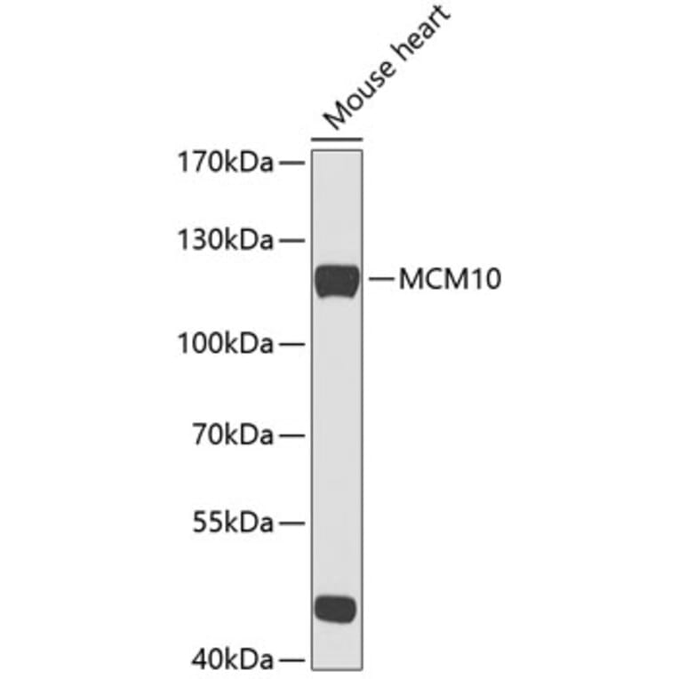Western Blot - Anti-MCM10 Antibody (A88083) - Antibodies.com