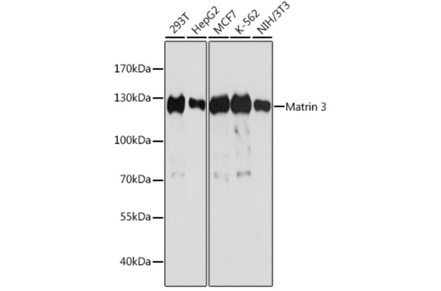 Western Blot - Anti-Matrin 3 Antibody (A88084) - Antibodies.com