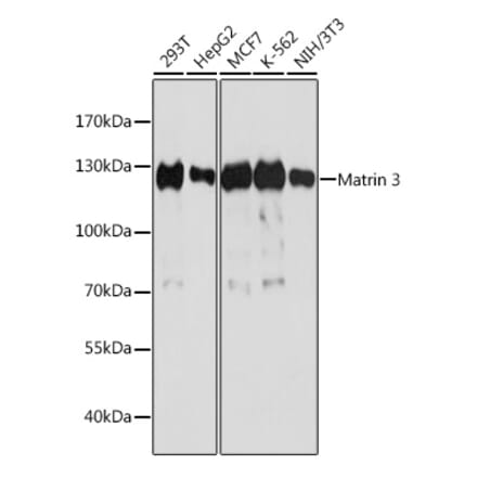 Western Blot - Anti-Matrin 3 Antibody (A88084) - Antibodies.com