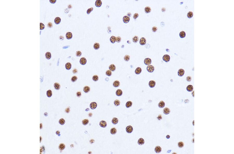 Immunohistochemistry - Anti-Matrin 3 Antibody (A88084) - Antibodies.com