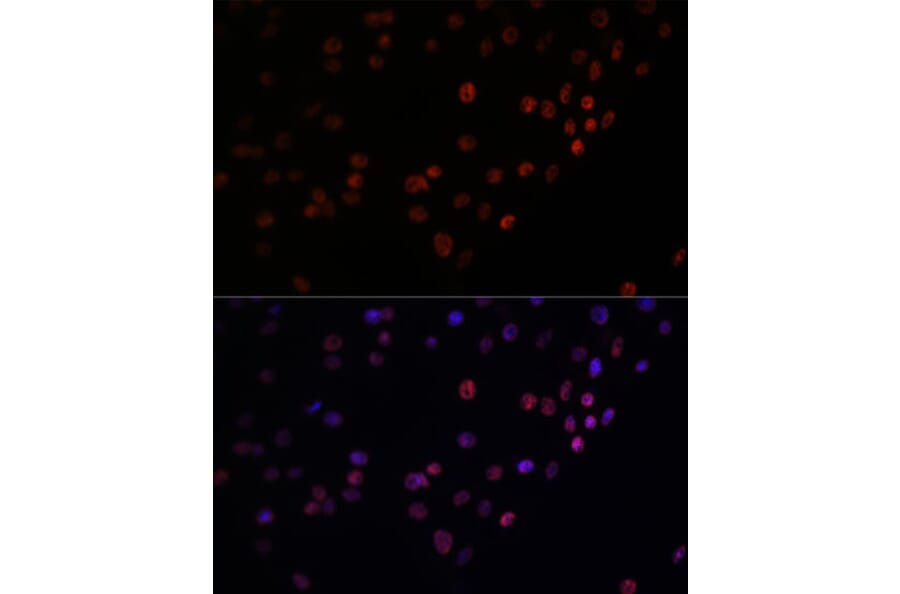 Immunofluorescence - Anti-Matrin 3 Antibody (A88084) - Antibodies.com