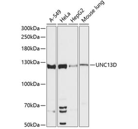 Western Blot - Anti-Munc 13-4 Antibody (A88085) - Antibodies.com