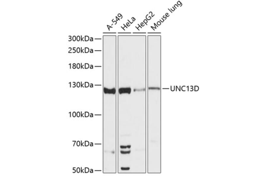 Western Blot - Anti-Munc 13-4 Antibody (A88085) - Antibodies.com