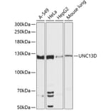 Western Blot - Anti-Munc 13-4 Antibody (A88085) - Antibodies.com