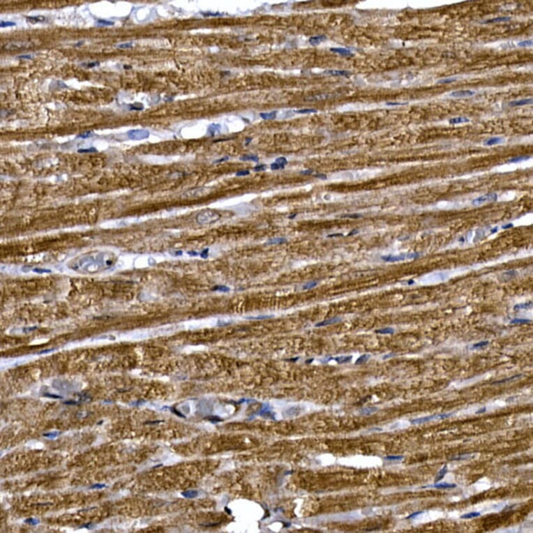 Immunohistochemistry - Anti-PDE3A Antibody (A88086) - Antibodies.com