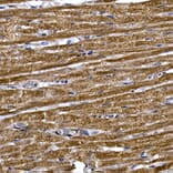 Immunohistochemistry - Anti-PDE3A Antibody (A88086) - Antibodies.com