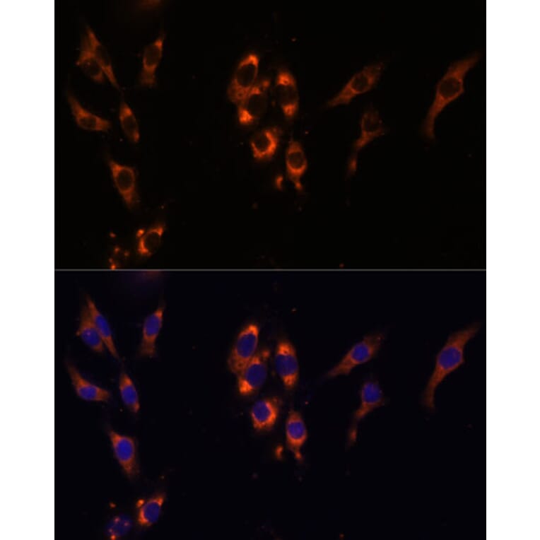Immunofluorescence - Anti-PDE3A Antibody (A88086) - Antibodies.com