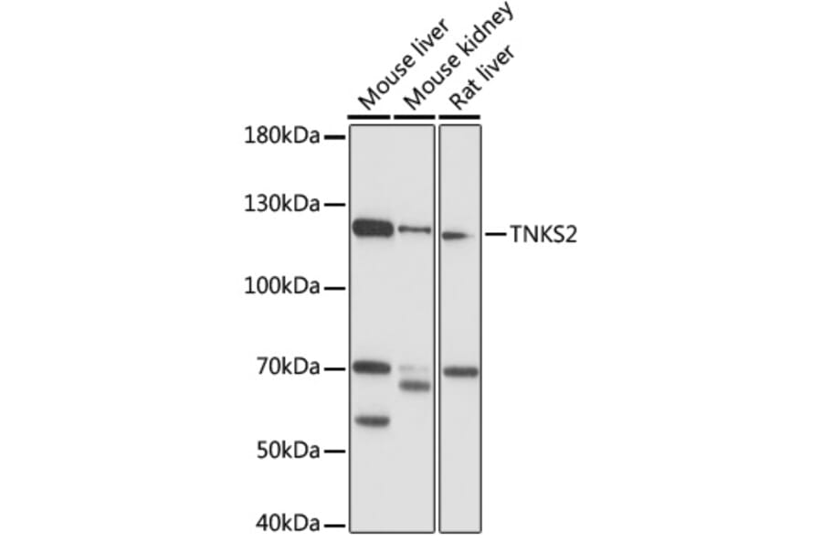 Western Blot - Anti-Tankyrase 2/TNKS2 Antibody (A88087) - Antibodies.com