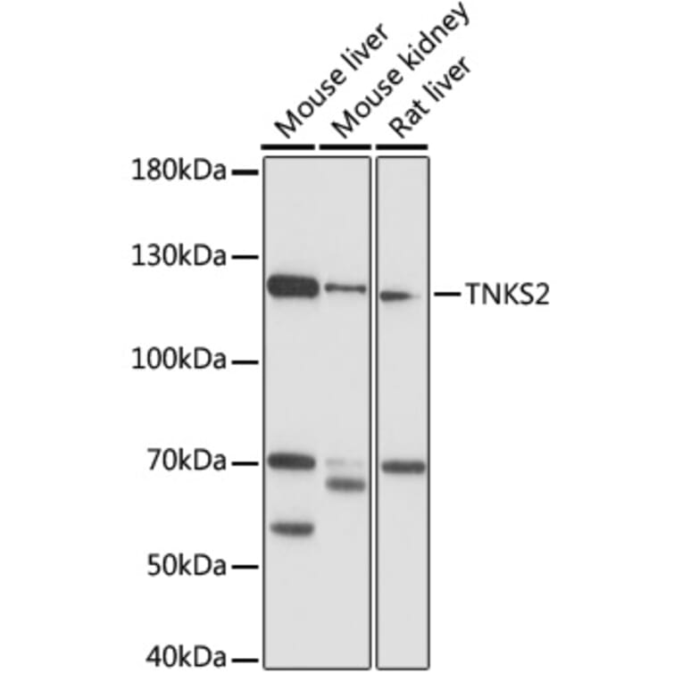 Western Blot - Anti-Tankyrase 2/TNKS2 Antibody (A88087) - Antibodies.com