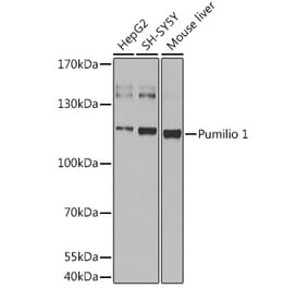 Western Blot - Anti-Pumilio 1 Antibody (A88088) - Antibodies.com