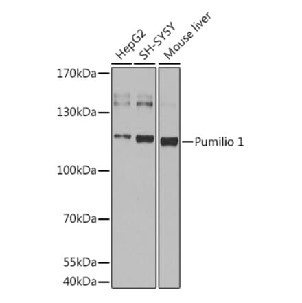 Western Blot - Anti-Pumilio 1 Antibody (A88088) - Antibodies.com