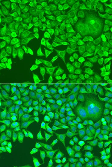 Immunofluorescence analysis of U2OS cells using Anti-pum1 Antibody (A13389) at dilution of 1:100. Blue: DAPI for nuclear staining.