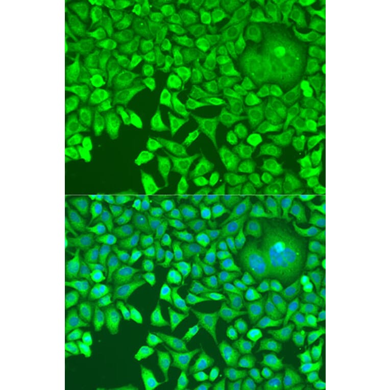 Immunofluorescence - Anti-Pumilio 1 Antibody (A88088) - Antibodies.com