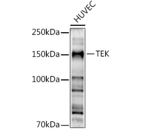 Western Blot - Anti-TIE2 Antibody (A88089) - Antibodies.com