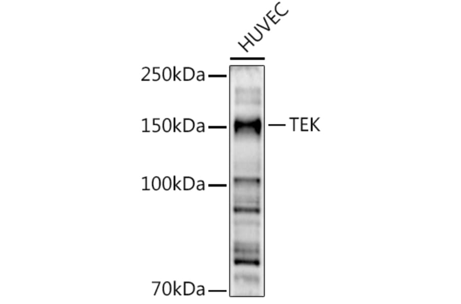 Western Blot - Anti-TIE2 Antibody (A88089) - Antibodies.com