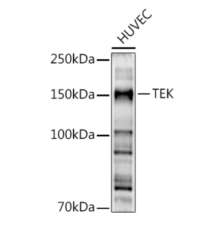 Western Blot - Anti-TIE2 Antibody (A88089) - Antibodies.com