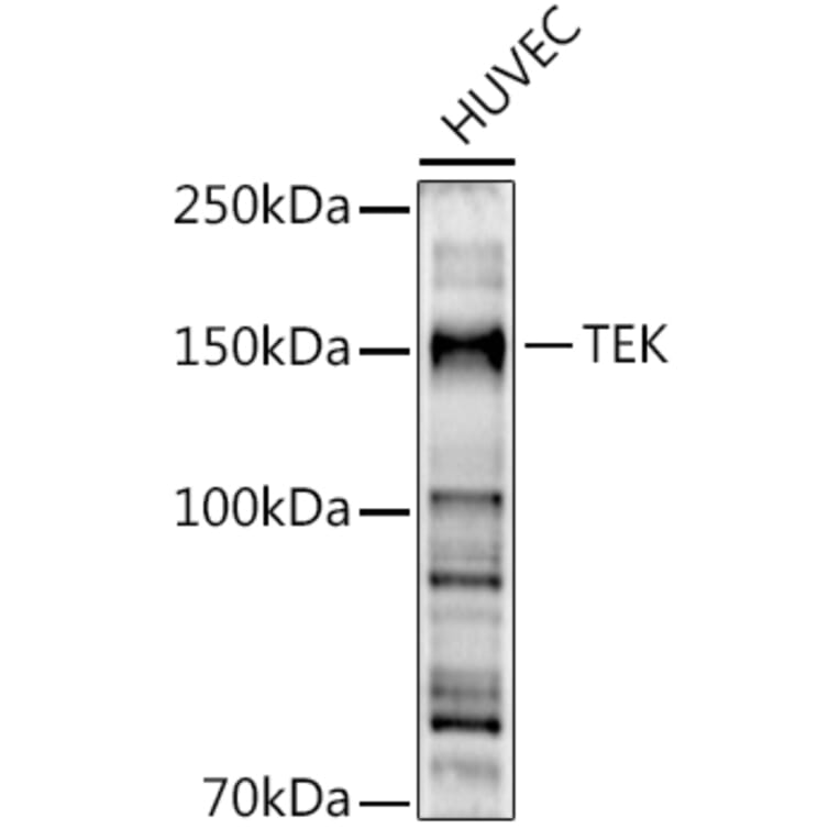 Western Blot - Anti-TIE2 Antibody (A88089) - Antibodies.com
