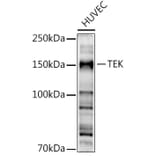 Western Blot - Anti-TIE2 Antibody (A88089) - Antibodies.com