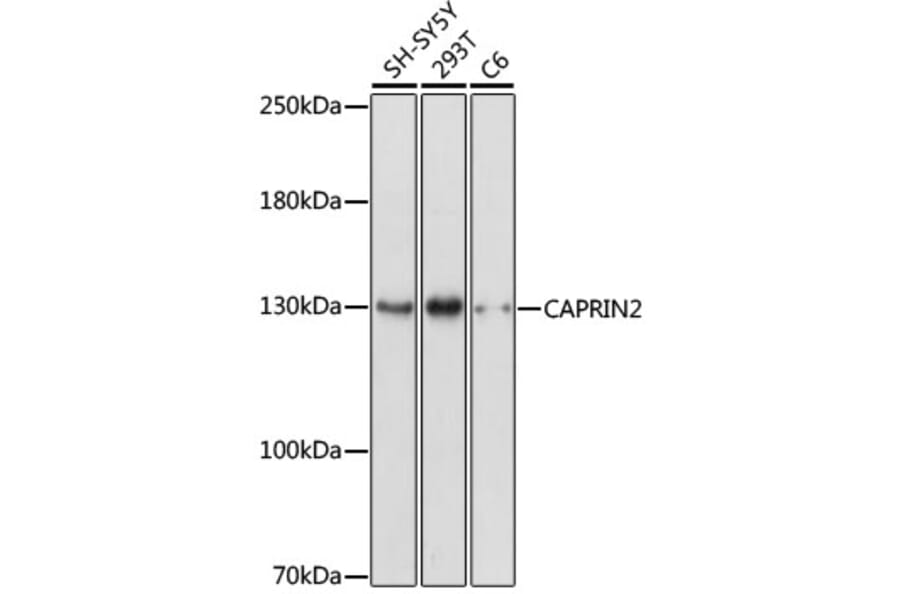 Western Blot - Anti-CAPRIN2 Antibody (A88090) - Antibodies.com