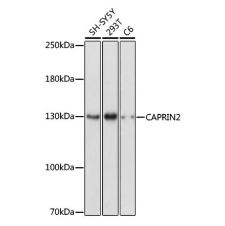 Western Blot - Anti-CAPRIN2 Antibody (A88090) - Antibodies.com