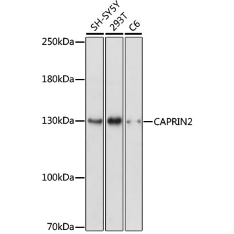 Western Blot - Anti-CAPRIN2 Antibody (A88090) - Antibodies.com