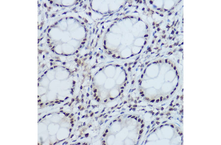 Immunohistochemistry - Anti-DDB1 Antibody (A88091) - Antibodies.com