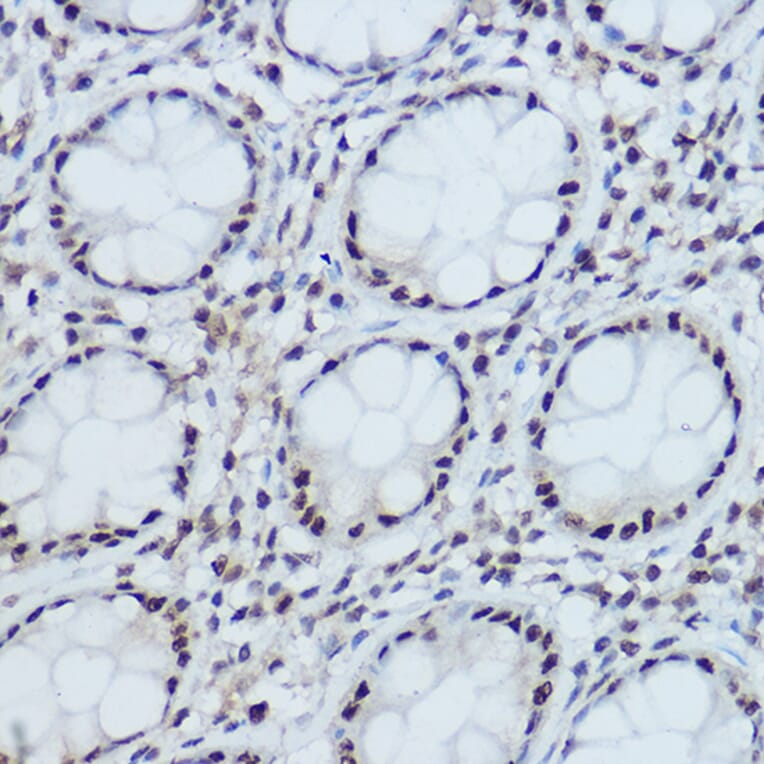 Immunohistochemistry - Anti-DDB1 Antibody (A88091) - Antibodies.com