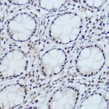 Immunohistochemistry - Anti-DDB1 Antibody (A88091) - Antibodies.com