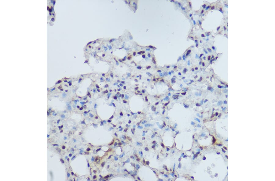 Immunohistochemistry - Anti-DDB1 Antibody (A88091) - Antibodies.com