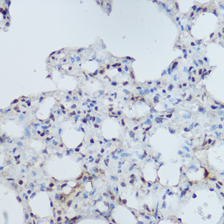 Immunohistochemistry - Anti-DDB1 Antibody (A88091) - Antibodies.com